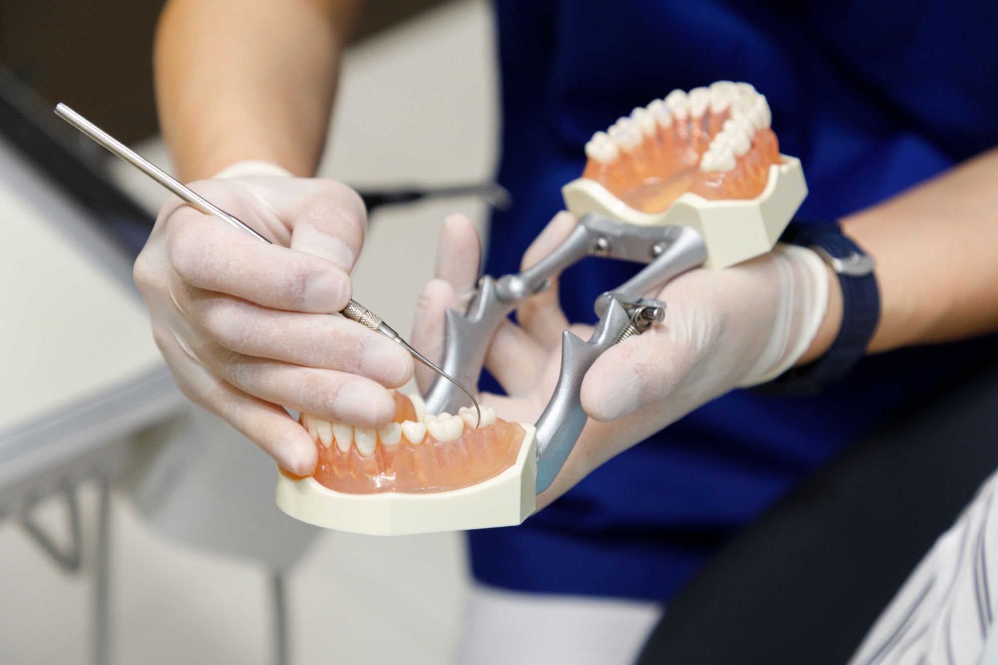 インプラント治療のメリット