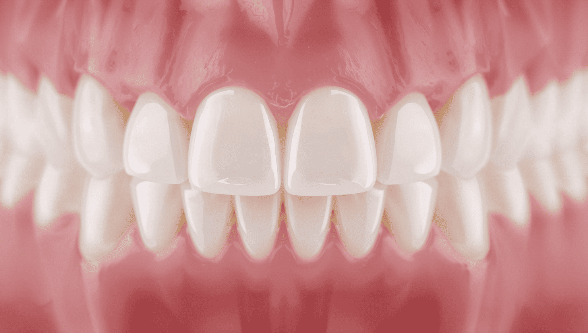 上部構造の種類について